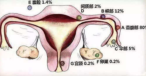 ��ǻ�׻������� Ů����ǻ������Щ֢״